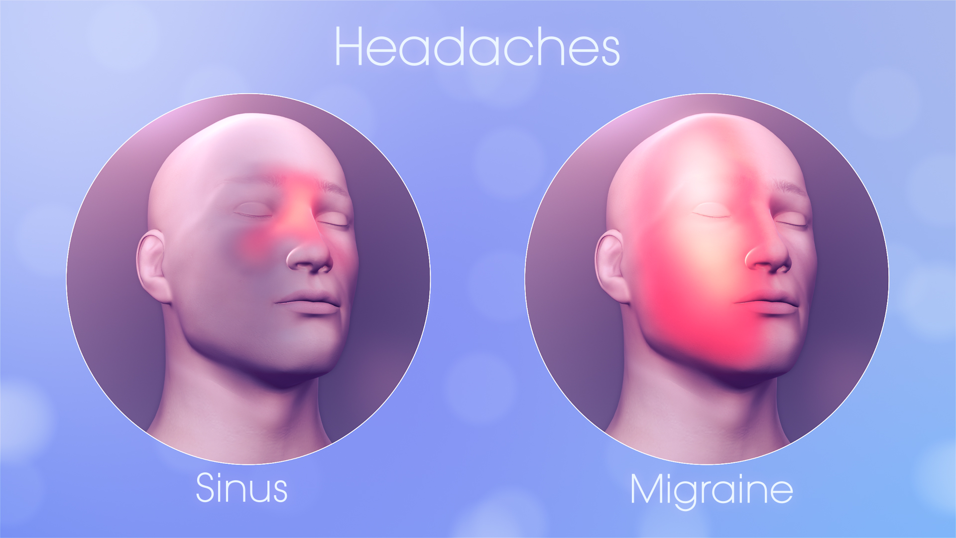 sinus-pain-symptom-migraine-problem