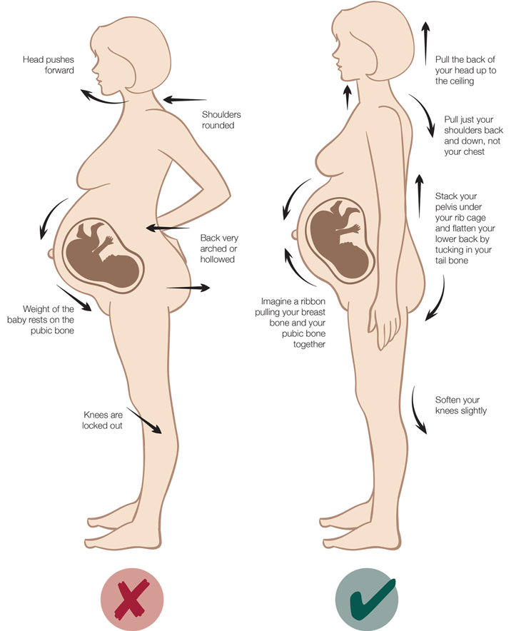 Pelvic Back Pain Relief During Pregnancy